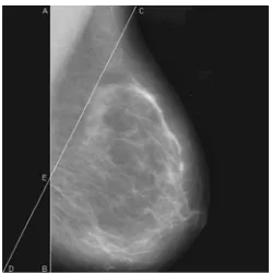 Figure 6 The Inverted Right Angle Triangle (ACE) 