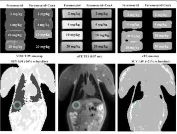 Figure 4 Ultra-short echo-time imaging after ferumoxytol administration. Example of how ultra-shortecho-time imaging can allow for detection of tissue anatomy even in the presence of high tissue iron content.The top row again reflects the same phantom as i