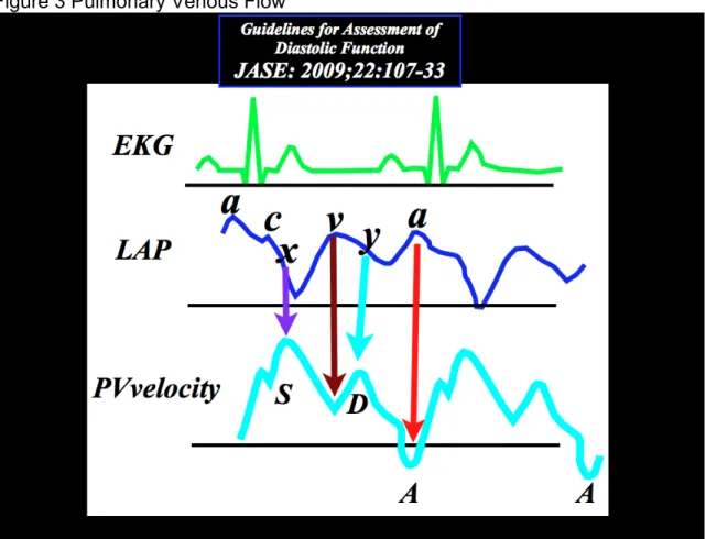 Figure 3 Pulmonary Venous Flow 