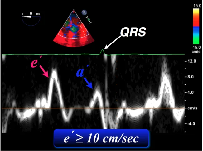 Figure 6: Color M-Mode Flow Propagation Velocity (Vp) 