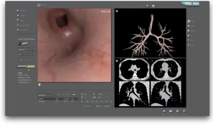 Figure 4: Screenshot of VR simulator display during a participant’s performance on 