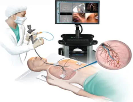 Figure 1: A flexible bronchoscopy procedure (Sydney Respiratory & Sleep Physician, n.d., 