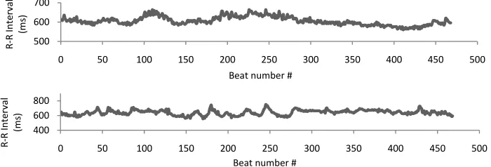 Fig. 1  R-R Interval tachogram of CHF patient (top) and normal subject (bottom). 