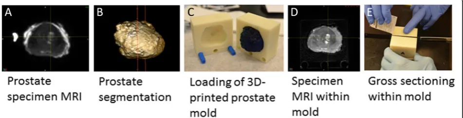 Fig. 1 Registration process step 1. Following prostatectomy, a 3D T2W MRI scan of the prostate specimen was performed (a), to accuratelysegment the specimen for generating a mold design (b)