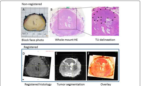 Fig. 2 Registration process step 2. Individual sections of the specimen were photographed (a) and whole-mount sectioned for HE histology (bThe tumor borders were marked by the pathologist (c)