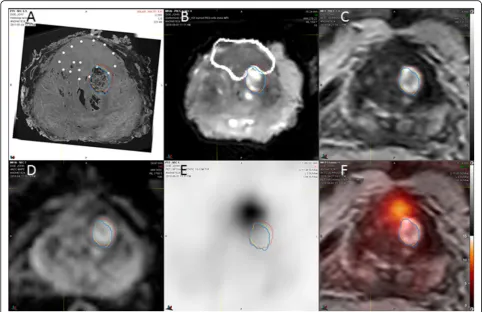 Fig. 3 Determination of registration accuracy. Registered transaxial HE histology (MRI (yellow), and in vivo MRI (red) are displayed on corresponding slices