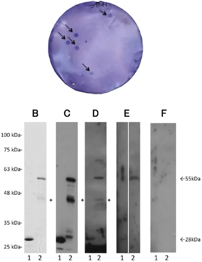 Figure 1: First screening by SEREX and Western blot analysis.  Recombinant proteins were blotted onto nitrocellulose membranes  and reacted with patient serum