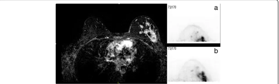 Table 2 Breast length measured from db-PET transaxial images