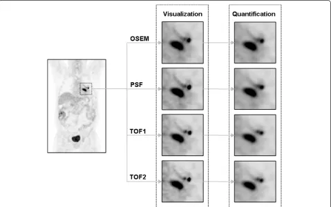 Table 2 Mean RSD of the RCs for each reconstruction protocol and across all protocols
