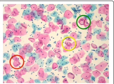 Fig. 6 A single “trial” in the search for cervical cancer. An actual casecould have many thousands of cells on it