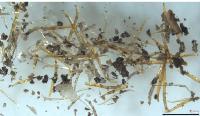 Figure 2.1 An example of the numerous earthworm chaetae of different sizes found in all of the faecal samples examined