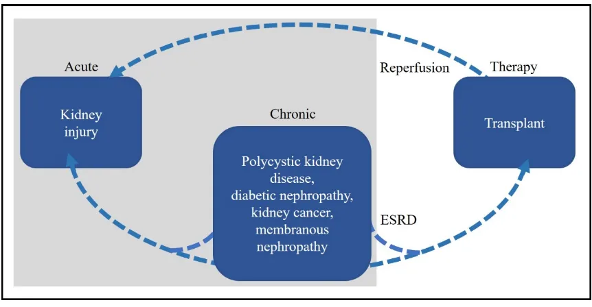 Figure 1.Figure 1. The overlapping relationships of the described kidney diseases. Chronic kidney disease and sub-entities: Polycystic kidney disease, diabetic nephropathy, kidney cancer and membranous nephropathy may progress to end-stage renal disease re