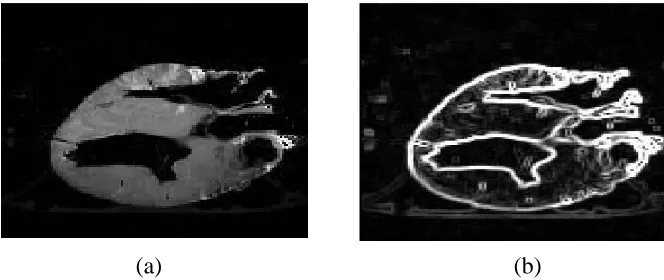 Figure 1.4: (a) Original MRI image of a dog’s heart. (b) Edge detection image.  