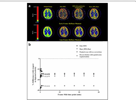Fig. 4 a Hoffman phantom images before and after applying IDM with and without spatial smoothing or HYPR for both shorter and longer framedurations
