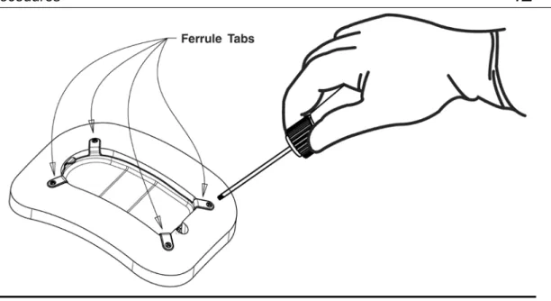 Figure 11: The four ferrule tabs secured to the skull with bone screws. 