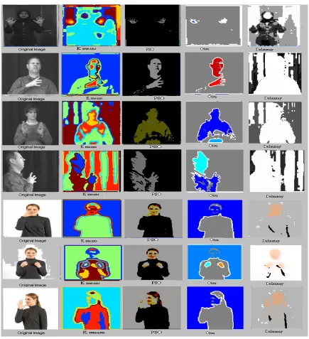Figure 4: Subjective assessment of the adopted segmentation methods 