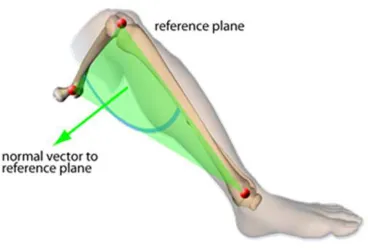 Figure 2: Ankle epicondyle piriformis (AEP) plane formed by the mid-point of the ankle malleoli, For Peer Review Onlyused instead of the condylar axis in imageless-navigation to define the neutral rotation of the femur