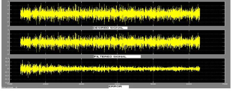 Figure 2: LMS Filter 