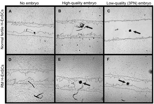 Figure 4. The migration zone after adding a high-quality, low-quality or no embryo. The migratory response of decidualized H-EnSCs fromnormally fertile (A–C) and RM women (D–F) was analyzed in absence of a human embryo (A and D), in presence of a high-qual
