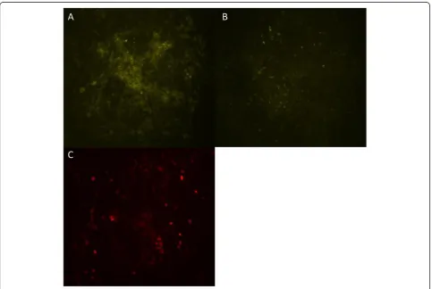Figure 2 Fluorescence microscopy of MT-YFP/GLuc (A), YFP/GLuc (B) and Red/GLuc (C) cell lines.