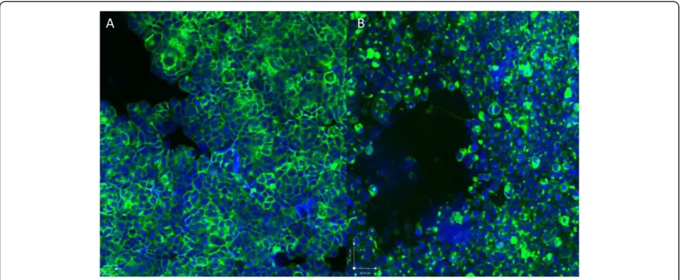 Figure 3 Confocal microscopy of MT-YFP/GLuc (A) and YFP/GLuc (B) cell lines, further localizing the fluorescent signal.