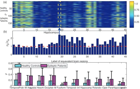 Figure 4. Asymmetry measure rtwo groups according tocorrespondingmean value. The most asymmetric brain region according tocorresponding to a subject, and each column represents each pair of equivalent brain regions.the bottom 100 rows are epileptic patient