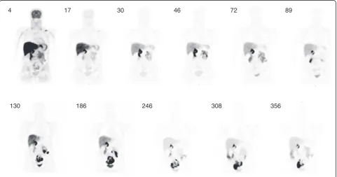 Figure 2 Series of PET whole-body images from 4 to 356 min after injection of florbetapir F 18.