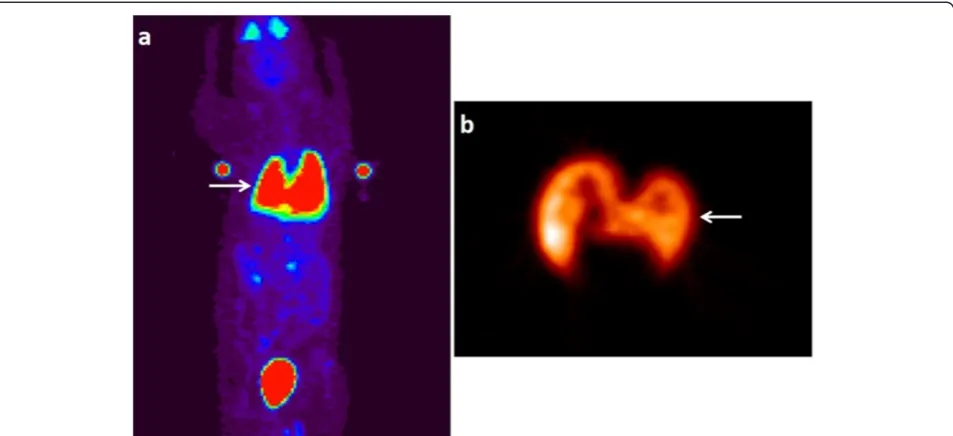 Figure 4 Biodistribution of labeled ASCs in a rat injected via left ventricle. Maximum intensity projection of whole-body PET image (a) froma rat injected with double-labeled ASCs via left ventricle (25 μg/ml SPIO and 1.34 MBq FDG)