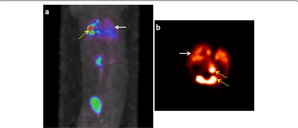 Figure 6 Histochemical and PCR results for tail vein injection. Microscopic pictures of histochemical assays (a); arrows indicate Prussianblue-stained SPIO in the cells