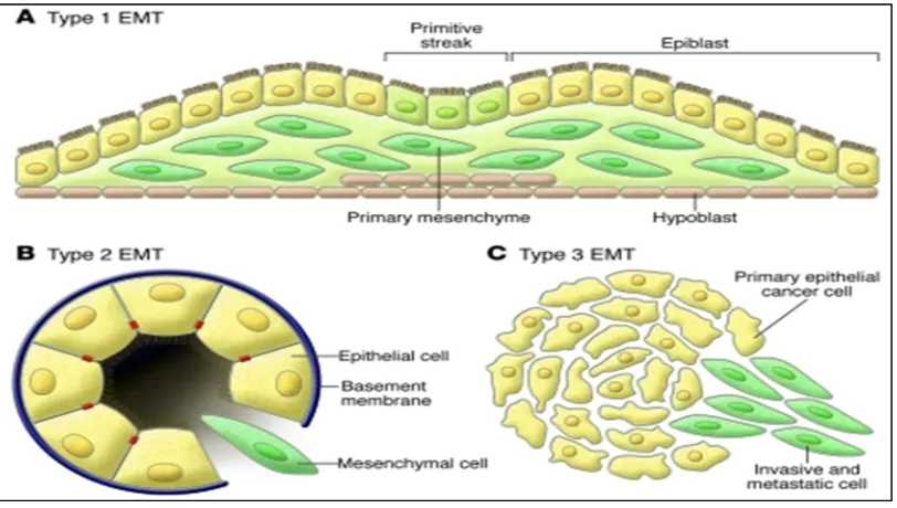 Figure 3: Different types of Epithelial mesenchymal transition 