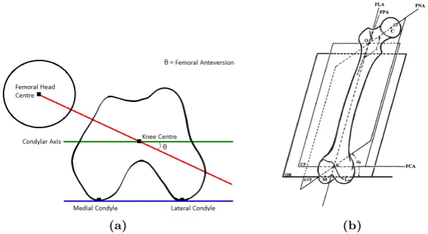 Figure 3.5: Measurement of osseous bump formation using(b) (a) βangle (Wyss et al., 2007) and Triangular index (Gosvig et al., 2007).
