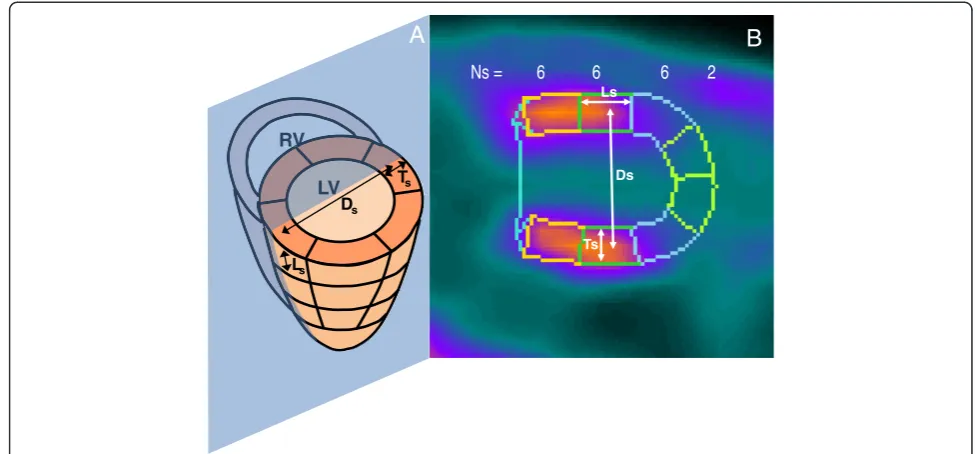 Figure 1 Measurement of the segments dimensions.by the QPS software on which measure were performed to determine the volume of each of the 20 segments s of the polar map
