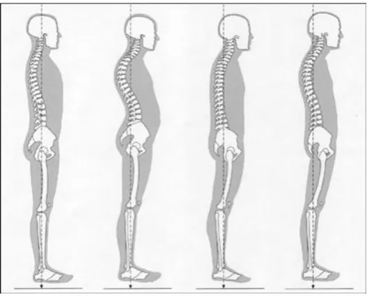 Figure 5, postures int he coronal plane. [15]