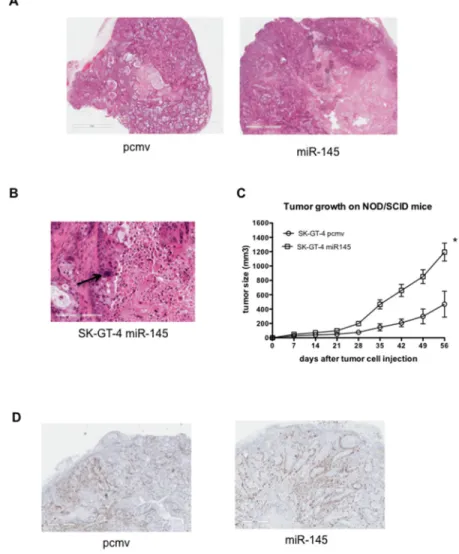 Figure 4: miR-145 expression in EAC cells leads to bigger tumors. (A) Histology of the SK-GT-4 pcmv (left) and SK-GT-4 