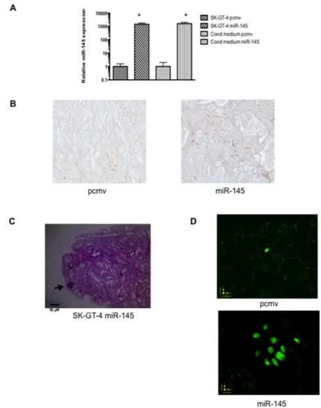 Figure  5:  miR-145  expression  in  EAC  increases  metastasis  but  not  angiogenesis  in  xenograft  model
