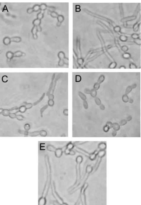 FIG. 5. Growth morphologies of C. albicansthe WT strain,(CaMs50-1) in YPSuc agar for 24 h at 37°C; and (C) colony morphology of the WT andYPSuc agar for 48 h at 37°C; (B) closeups of the WT strain, SC5314 and SFL2 deletants under agar-embedded (microaeroph