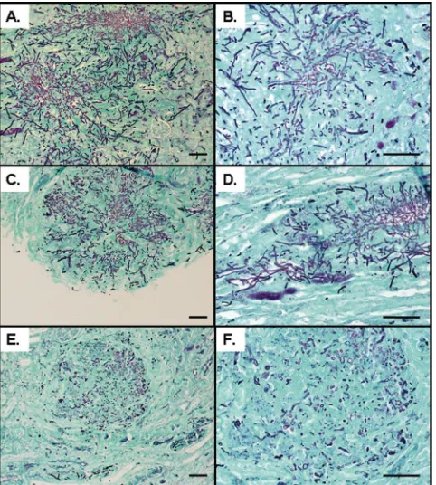 FIG. 8. Morphology of C. albicans SFL2show thekidneys. Kidney sections (5methenamine silver and poststained with light green