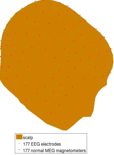 Fig. 2. Combined MEG/EEG sensor array with 177 normal MEGmagnetometers and 177 EEG electrodes