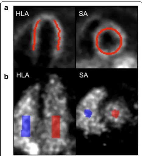 Fig. 1 aband left ventricle ( Example myocardium volume of interest (VOI), overlaidon a K1 image in horizontal long axis (HLA) and short axis (SA)