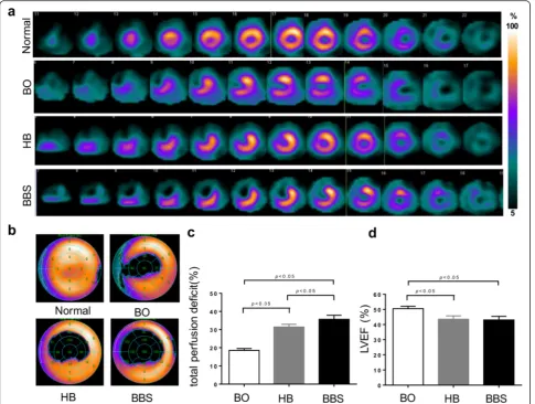 Fig. 7 Myocardial perfusion by SPECT/CT imaging.and perfusion defect in three groups 3 months post-MI