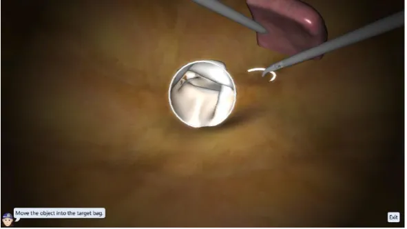 Figure 3 - The Cutting Task. The left instrument are ultrasonic scissors, the right one is a grasper