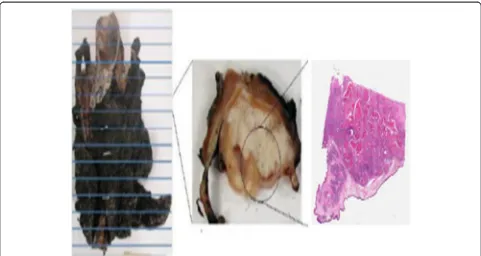 Fig. 5 In vivo CT (left) and the corresponding ex vivo CT (right) of the pathology specimen