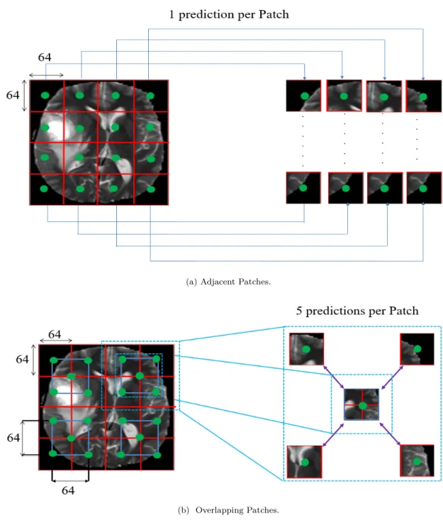 Figure 2: Examples of A) Adjacent Patches (one prediction per Patch) and B) Overlapping Patches (5 predictions per Patch) from an input MRI image