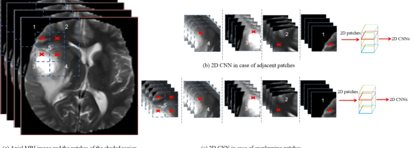 Figure 5: Examples of (a) a MRI image (Axial view) and the patches of the shaded region, where the red cross signe represents the shared region with the patch number 5