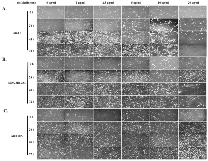 Figure 3: Microscopic morphology of MCF7, MDA-MB-231, and MCF10A cells at various times after treatment with  indicated concentrations of cis-khellactone