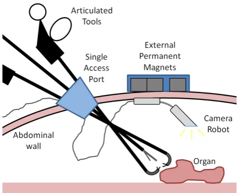 Figure 2. Schematic representation of the entire robotic endoscopewith the compliant MLS