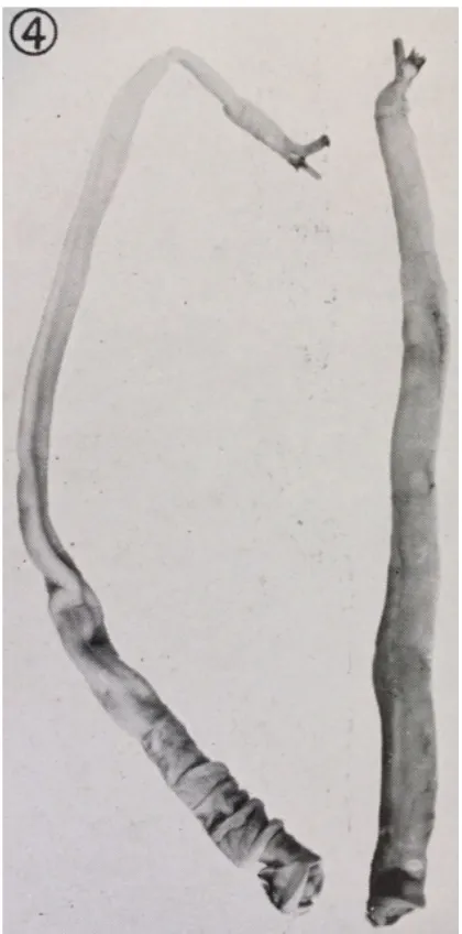 Figure 3: Teredo navalis. The shells sit atop the anterior ends (bottom of image), and their siphons and pallets jut out from the posterior (top)