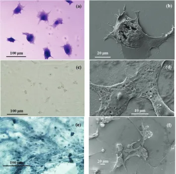 Figure 3: Optical (left) and field emission scanning electron microscopy (right) images of Cos-7 (a, b), Vero (c, d), and Madin-Darby CanineKidney (e, f) cell lines showing attachment to the electrochemically engineered Anodic Aluminium Oxide membrane