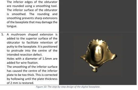 Figure 10: The step-by-step design of the digital baseplate. 