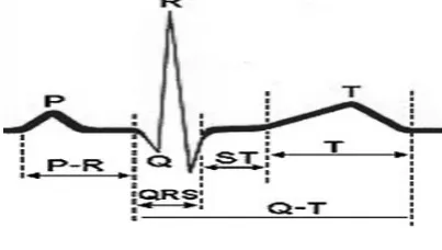 Figure 1- The Normal ECG waveform 